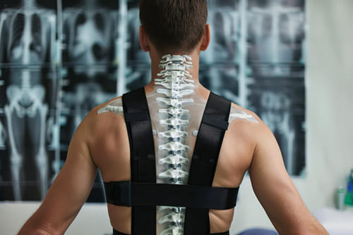 Tratamiento Conservador de la Columna Vertebral: Alternativas No Quirúrgicas para el Cuidado Espinal