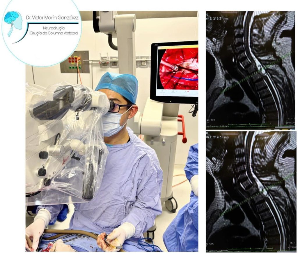 consulta-con-neurocirugia-y-cirugiadecolumna-cerca-de-mi